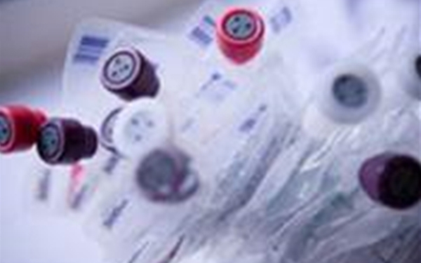 塑料粘結(jié)前等離子表面處理